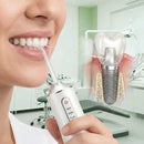 Irrigador Dental ImplaClean | Higiene Oral Avançada